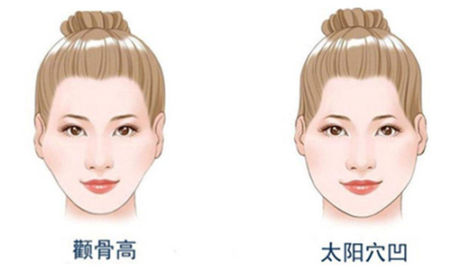 額頭