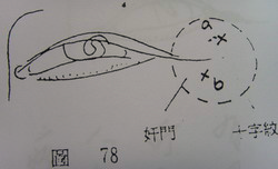 奸門