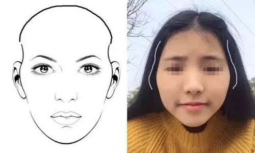 額頭