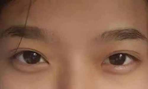 從眼內(nèi)角內(nèi)眥或圓或尖看一個人的面相運勢特點
