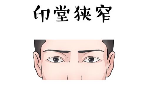 印堂